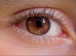 Orang yang pertama meletakkan jabatan khalifah dalam islam : Tubuh Kedutan Dan Bergetar Pertanda Apa