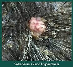 In dogs, they are common on the head, neck, back, eyelids and limbs. Disease Spotlight Skin Tumor Sebaceous Gland Hyperplasia Animal Dermatology Referral Clinic Adrc