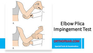 Image result for Elbow Extension Test