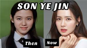 Son Ye Jin's plastic surgery