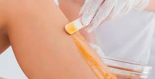 Agdadan Sonraki Yanma Ve Kizarikligin Cozumu Kadin Ne Der