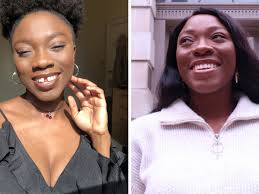 I can't imagine getting married with those teeth': how Britain fell for  adult braces