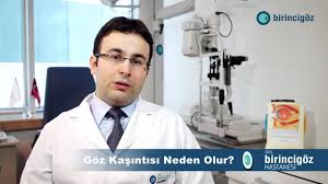 Goz Kasintisi Neden Olur Youtube