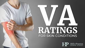 Va Disability For Skin Conditions Hill Ponton P A