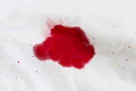 But if you tackle the stain with the right technique and the right whether it's from a cut, a bloody nose, or your period, getting blood out of clothing, or other types of fabrics, requires immediate action if you want to. How To Remove Dried Blood Stains From Silk Pandasilk