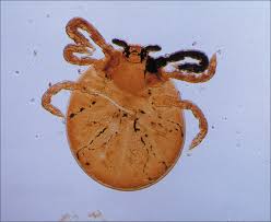 Image result for Trombicula autumnalis bites