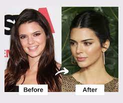 And it looks surprisingly edgy, too. Kendall Jenner Plastic Surgery And Skin Care Secrets 2021