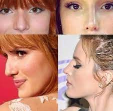 Plasticsurgery Nose Job Rhinoplasty Nose Jobs Nose Fillers