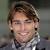 Male Pattern Baldness Long Thin Hair Men