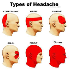 Headache Location Meaning