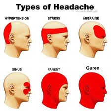 headache location meaning