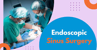 Image result for Sinus Surgery