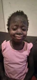 PAUL C ZAMBIA writes... UPDATE ON PEGGY 2 weeks ago most of you joined a  fundraiser for Peggy the time she needed you the most and you responded  massively. I want to