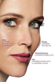 Two or more syringes are $587.50. Juvederm