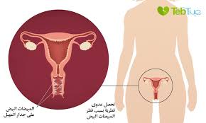 حكة المهبل الاسباب الاعراض الوقاية والعلاجات طب تايم
