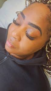 Looking for an affordable esthetician for micro-needling?