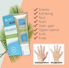 Jadi ada banyak cara alami untuk menghilangkan bekas gigitan nyamuk pada bayi. Melaleuca Therapy Cream Krim Ekzema Parut