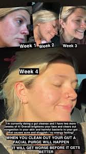 Did You Know?? True Story! If You Survived The Traps Keep Smiling Heads Up  😎🤣🤣🤣🤣