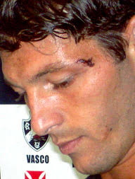 GloboEsporte.com > Futebol 2008