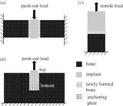 Maybe you would like to learn more about one of these? Biomechanical Behaviours Of The Bone Implant Interface A Review Journal Of The Royal Society Interface