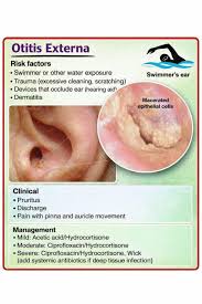 Image result for Acute Otitis Externa