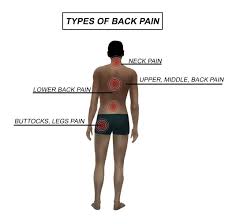 Pin On How To Stop Back Pain