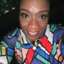 Alopecia "THE BALD BEAUTY!"