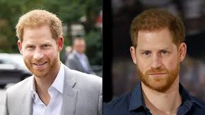 Hair transplant clinic credits Prince Harry for 100% rise in beard  transplants