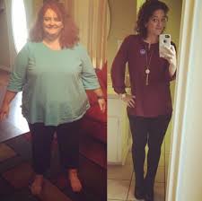 Weight Loss Surgery In Philadelphia Bariatric Surgery Source