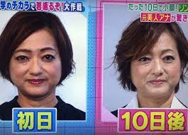 画像あり リンパずらし とは 10日でほうれい線とたるみに効果との噂 くらため帖 リンパ 小顔 ダイエット フェイスマッサージ