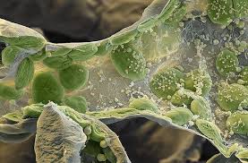 Light microscopy 2 plant cell (2): Chloroplasts Chloroplasten Mikroskope Pflanzenzelle Biologie
