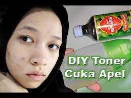 Selain itu jika kamu sudah sakit, mengonsumsi cuka apel yang dicampur dengan madu dan air perasan jeruk lemon mampu meringankan penyakit pilek dan demam yang kamu derita. Diy Toner Cuka Apel Untuk Menghilangkan Jerawat Dan Memudarkan Bekas Jerawat Aha Alami Youtube