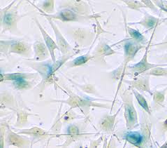 Some have been increased up to 5,000 times! Eurekalert Science News Releases