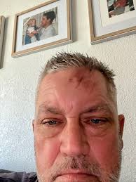 Scott Linzey Obituary March 26, 2025