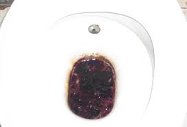 Image result for dark black stool human poop