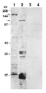 Image result for White 1999 AAV