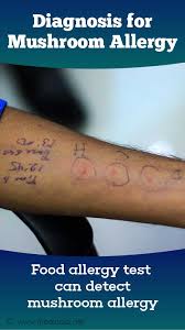 Raised, itchy, and often red bumps may pop up on your skin if you consume or come into contact with an allergen. Mushroom Allergy Causes Symptoms Diagnosis Treatment Prevention