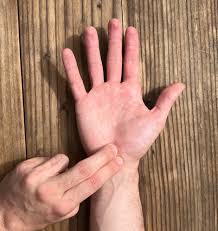 Image result for Carpal Compression Test