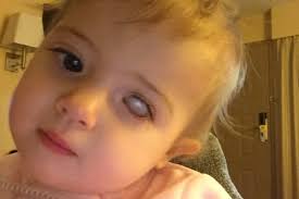 Fundraiser by Mike Winder : Baby Abigail needs an eye!