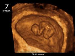 Pin On Pregnant