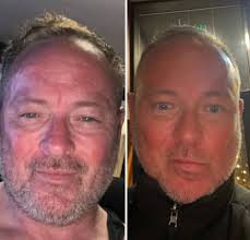 Six months of sobriety and reversing aging