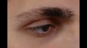 Eyebrow hairs are no exception. Atopic Dermatitis Eczema Causes Thinning Eyebrow Hair Tips To Overcome Youtube