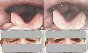 Image result for Tensilon Test