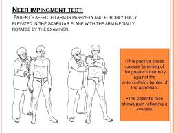 Image result for Neer Test