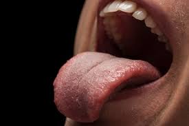 We did not find results for: Puntini Rossi Sulla Lingua Cause Sintomi E Rimedi Ireos Dental
