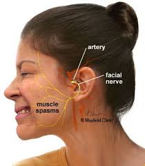Pin By Jennifer Hays On Yuck Facial Nerve Muscles Of Facial Expression Muscle Spasms