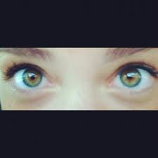 Pin By Melissa Snyder On Human Science Heterochromia Rare Eyes Central Heterochromia