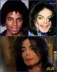 😢🕴️ The Heartbreaking Truth Behind Why Michael Jackson Drastically  Altered His Face—A Story of Pain, Pressure, and Personal Struggle 💔🎭 Read  more details in the comments below 👇👇👇