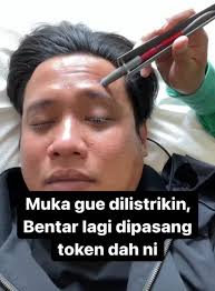 Dari hal ini mampu menyebabkan adanya perubahan pada bentuk area wajah, dimana wajah itu akan tampak melorot, dan tentunya kondisi ini mampu datang secara tiba tiba tapi meskipun begitu memiliki kebanyakan penderitanya hanya mengidap sifat sementara tapi juga ada yg. Mengenal Bells Palsy Yang Diderita Oleh Gofar Hilman