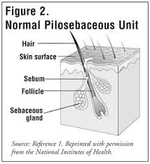 Pilosebaceous Unit Google Search Ingrown Hair Infected Ingrown Hair Treat Ingrown Hair